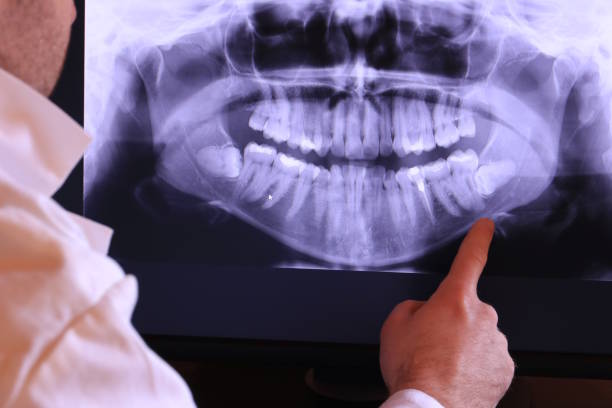 Best Emergency Dental Care for Broken or Chipped Teeth in Amity Gardens, PA