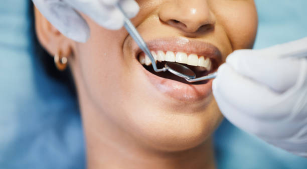 Best Emergency Dental Care for Broken or Chipped Teeth in Amity Gardens, PA