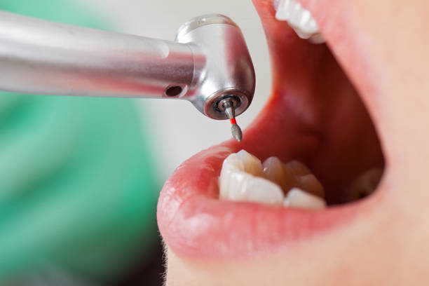 Best Emergency Gum Treatment in Amity Gardens, PA
